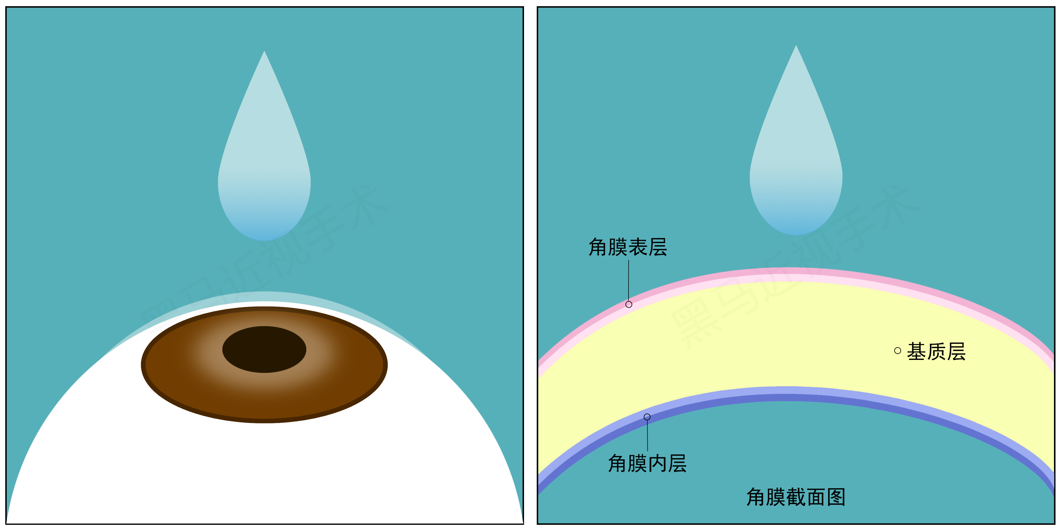 全飞秒步骤一