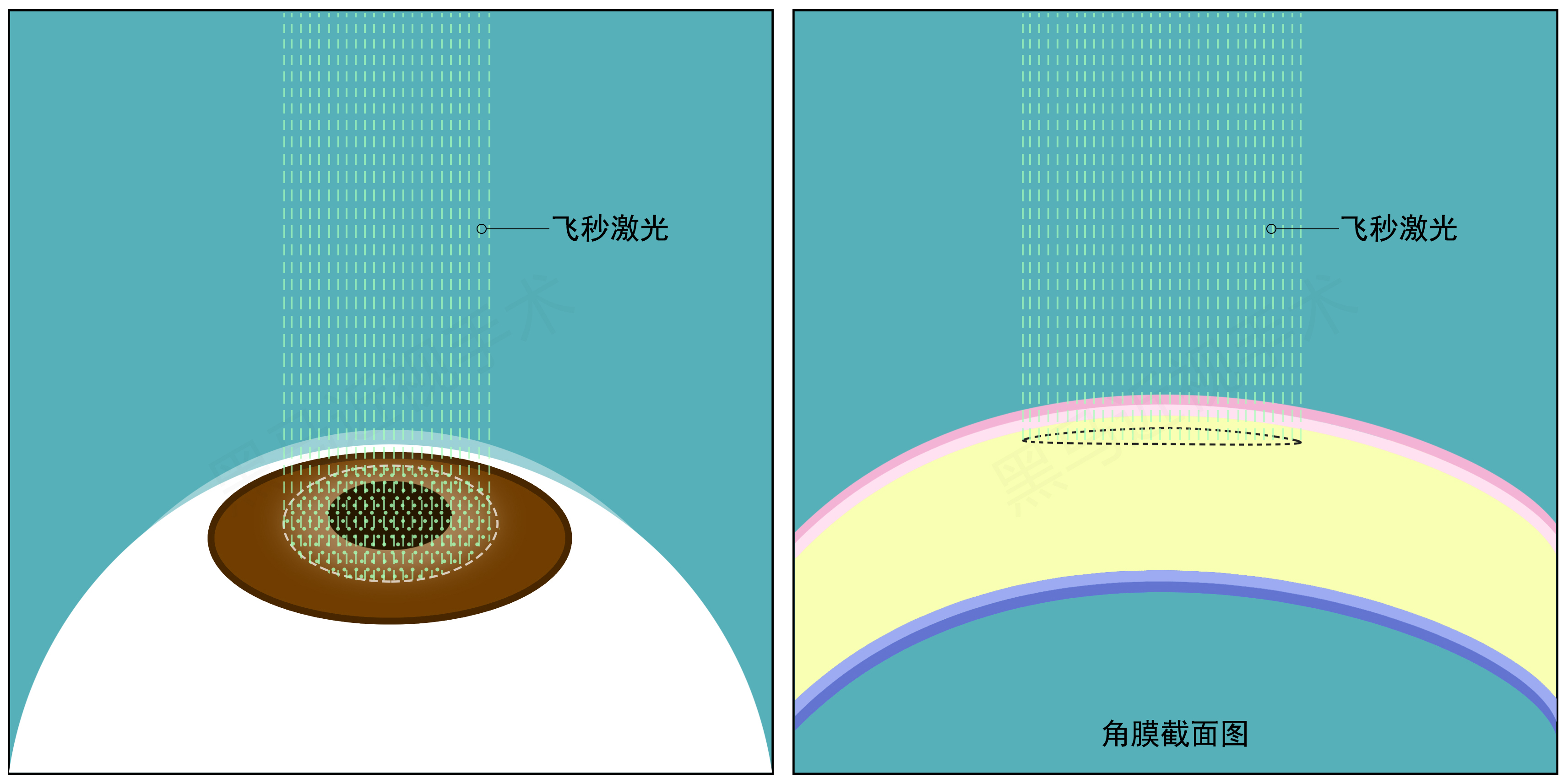 全飞秒步骤二