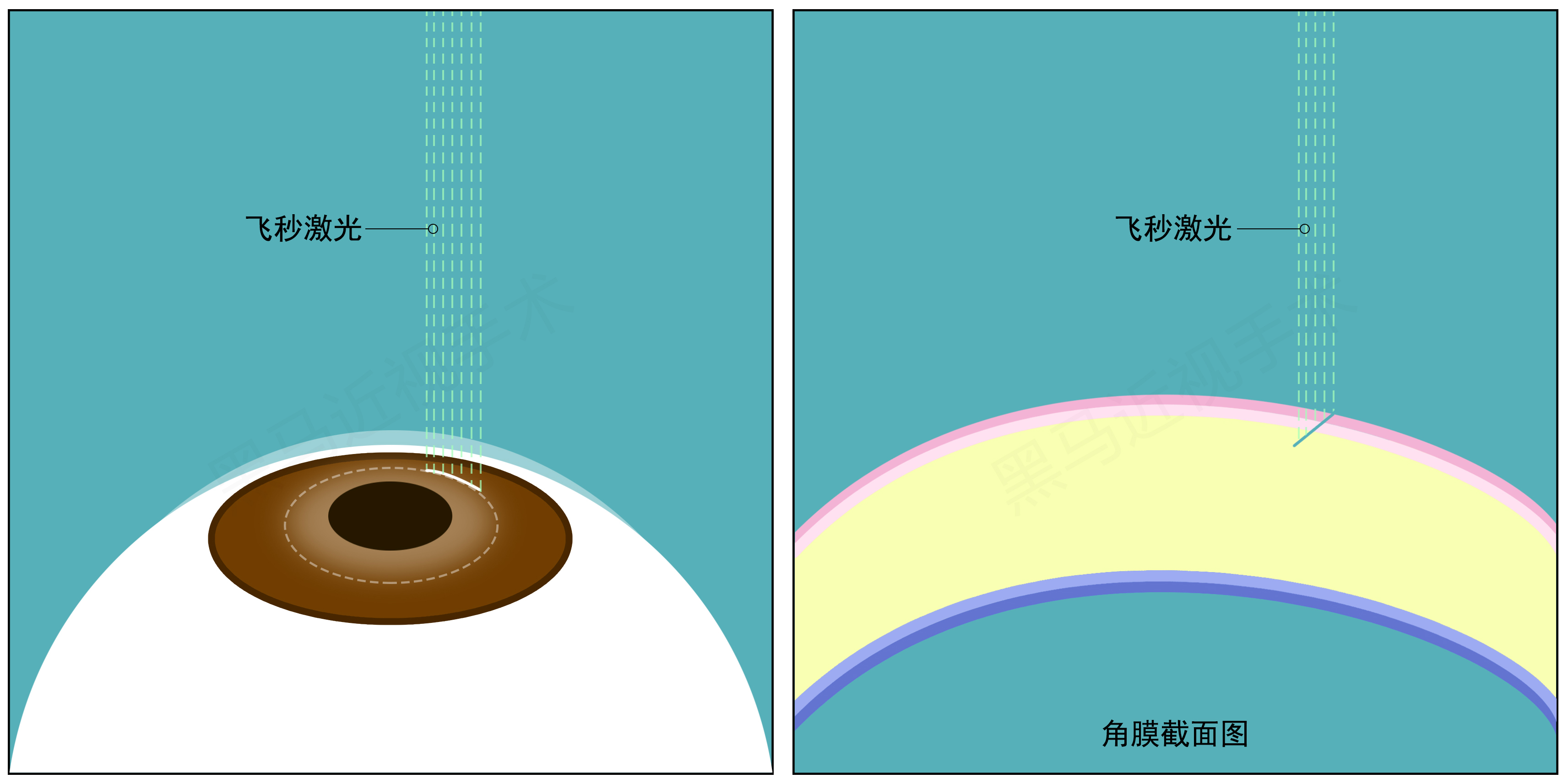 全飞秒步骤三