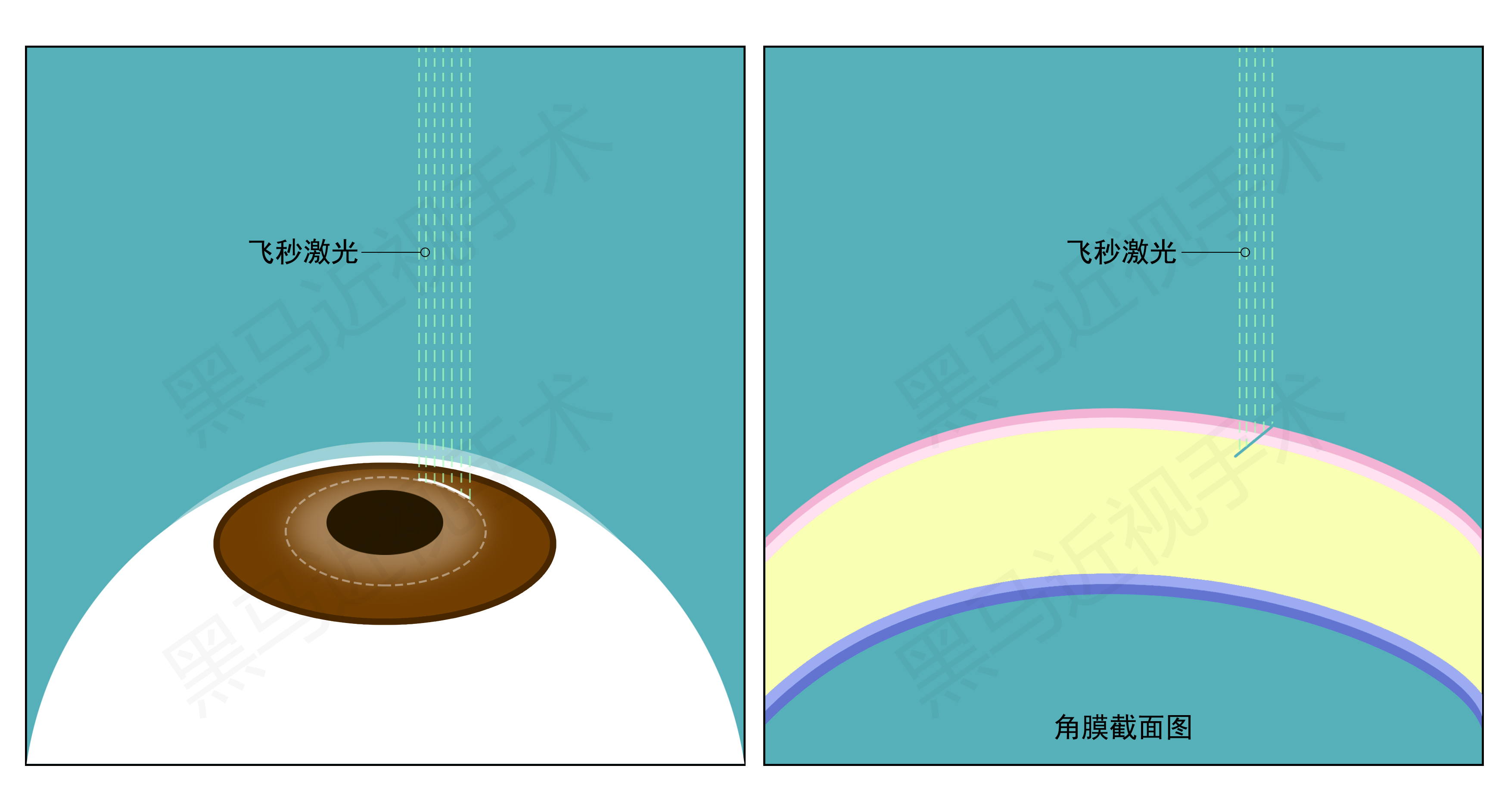 深圳黑马眼科